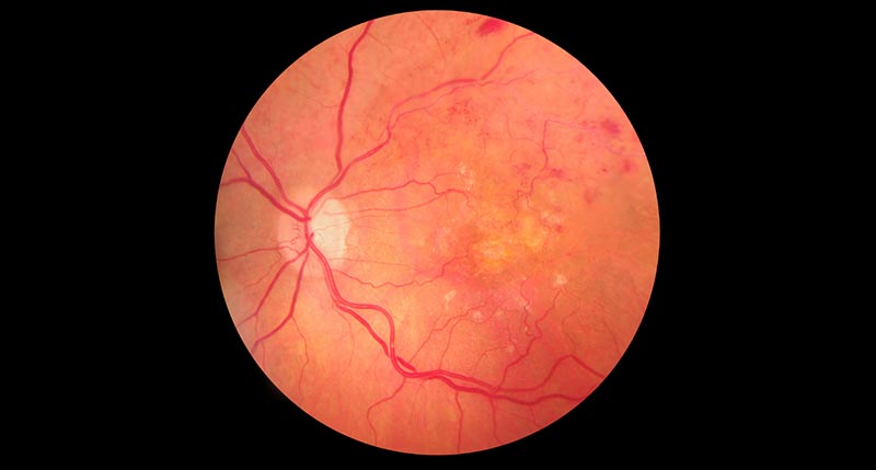 retinal imaging adult pediatric eyecare local eye doctor near you.jpg